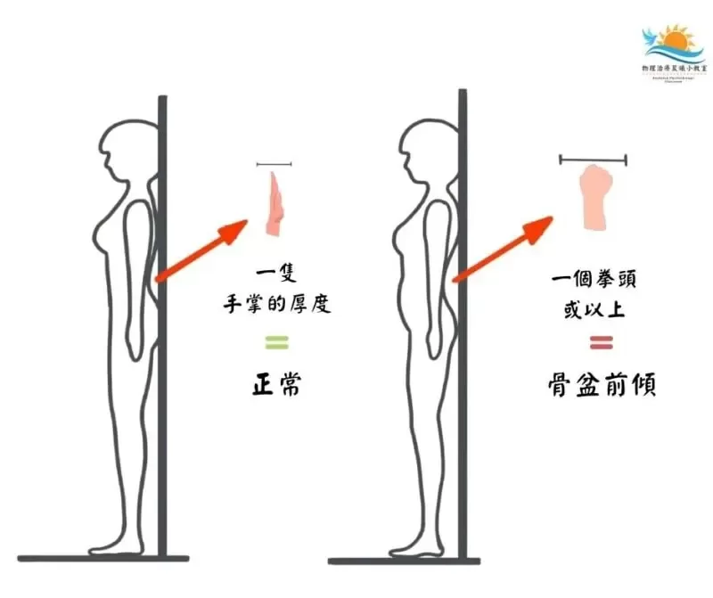 靠墙检测骨盆前倾姿势的自我测试示意图