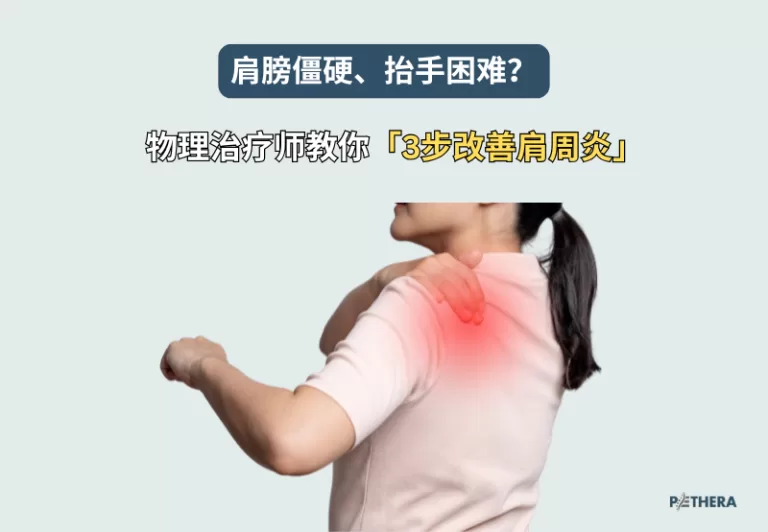 物理治疗师教你3步改善肩周炎