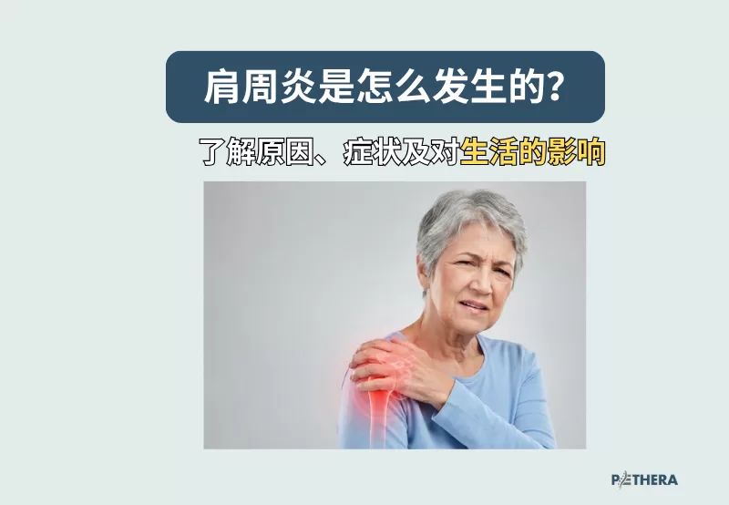肩周炎是怎么发生的